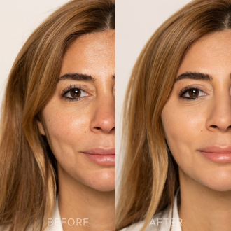 Olcay Gulsen Beauty Miracle Blur 2.0