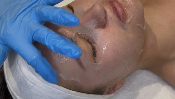 SQT Bio Microneedling Kuur